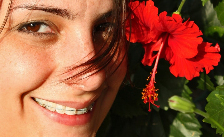 Woman with braces next to red flower smiling